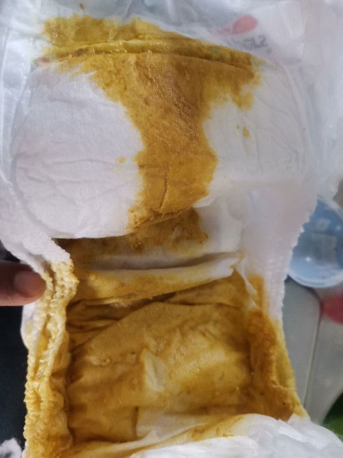 Baby 10 bulan 6hari kerap membuang???