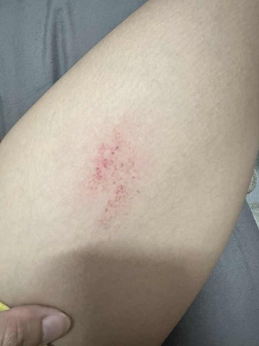 ขอสอบถามแม่ ๆ ค่ะ