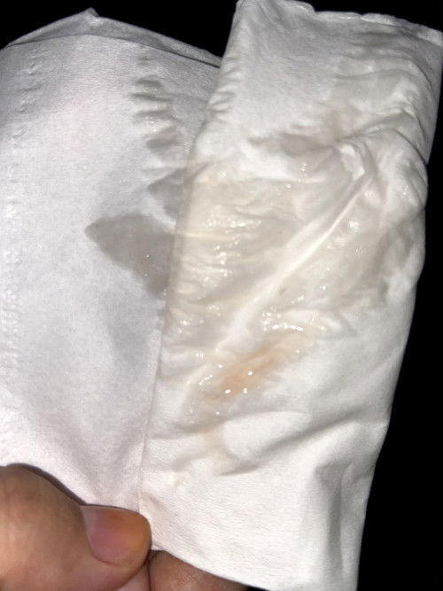 Lendir atau ketuban sama ga?