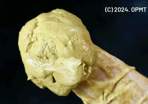 Normal ba poops ni baby