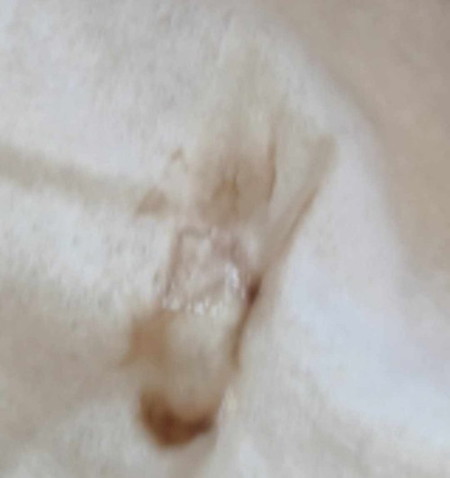 Signs of labor na ba? 39 weeks pregnant with brown sticky discharge