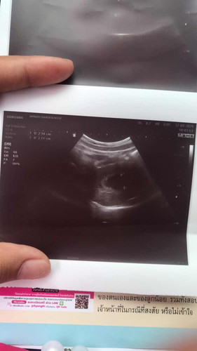 ท้องได้10วีค2วันเเล้วค่ะ