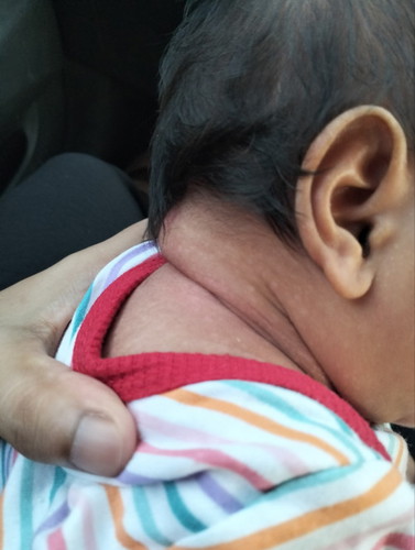 Macam mama nk hilangkan bintik2 macam ni..awal2 naik ruam merah kecik2 lepas hilang ruam jadi warna