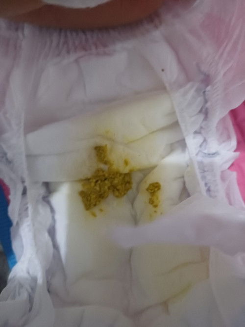 First time mom poop problem