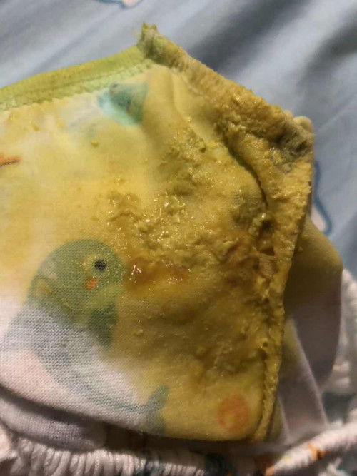 เด็ก4เดือน20วัน