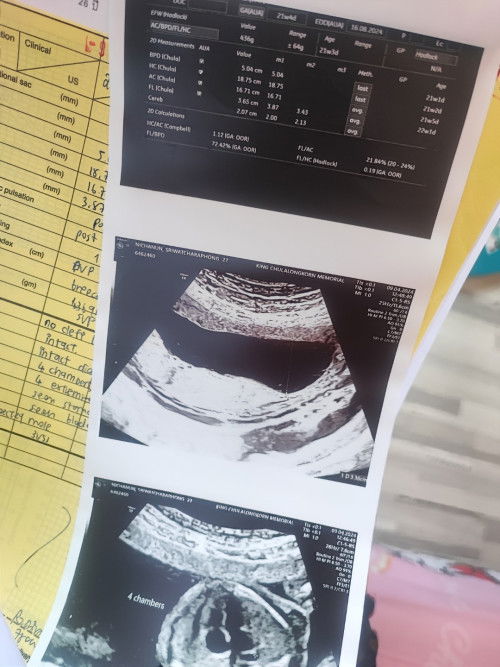 น้ำหนักแม่ขึ้นน้อยท้องเล็กมาก