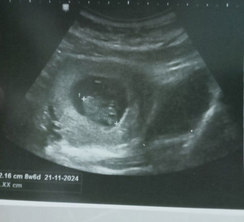 Berbagi cerita bunda