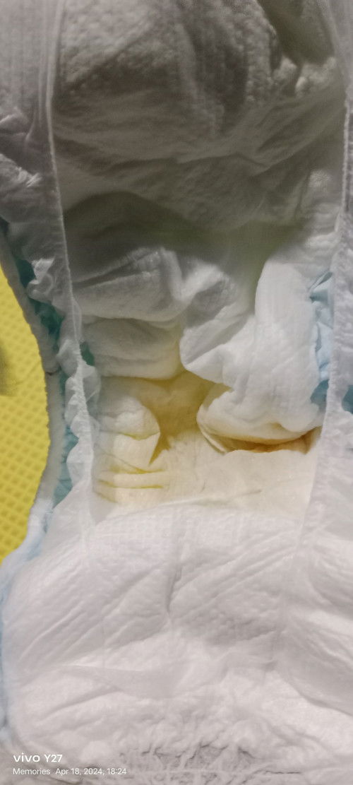 Ask lang po, naworried po kasi ako.