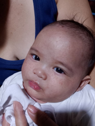 Ano po kaya yan Rashes po ba?