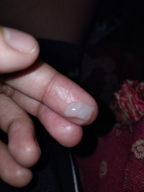 Keputihan atau apa d usia 40week 4 day