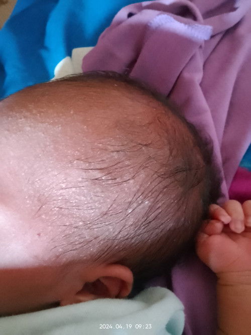 Halo bunda, izin bertanya. Kira-kira ini apa dan solusinya bagaimana ya