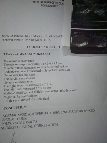 Ultrasound
