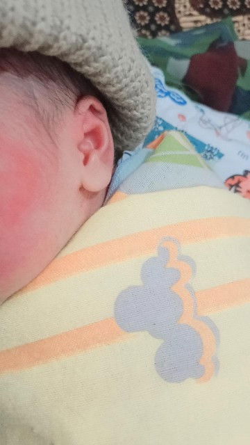 Hpl hpht 25 april/Hpl USG 14 mei