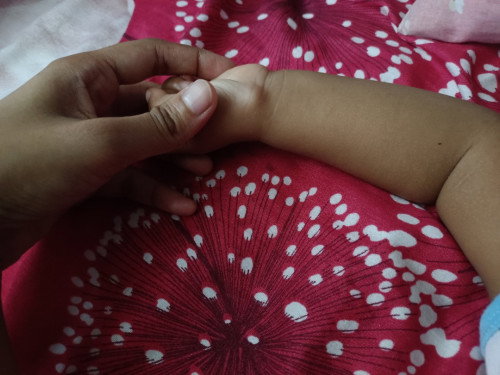 Ketulan di pergelangan tangan baby