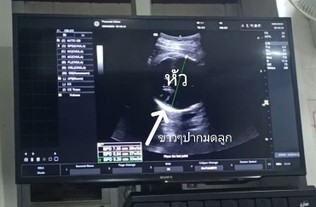 แบบนี้ใกล้คลอดยังคะ