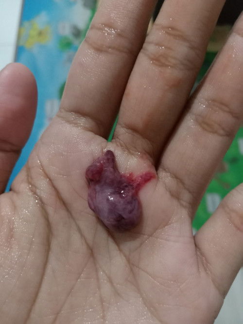 Ada yang Pernah Ngalamin ini?