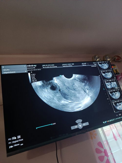 Claiming, Maifesting, Praying for Positive Pregnancy