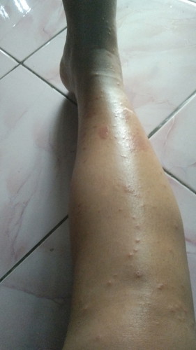Ada yang tau itu kenapa y?π