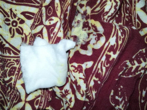 Bayi 3 bulan gumoh warna kuning