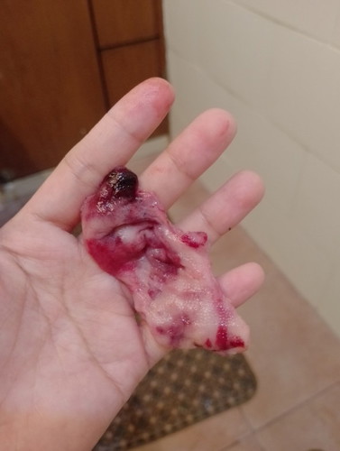 Ask ko lng Po pag ganto poba Ang lumabas nakunan puba Ako?,😭 1 month na Kasi akong delay
