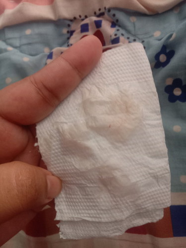 35+4วีค มีอาการเจ็บเตือนบ่อยแต่วันนี้หลังจากฉี่เหมือนมีเลือดปนตกขาวออกมาตลอด