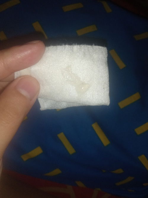 Bun tadi perutsanya kenceng terus mispagina ngilu terus keluar lendir putih