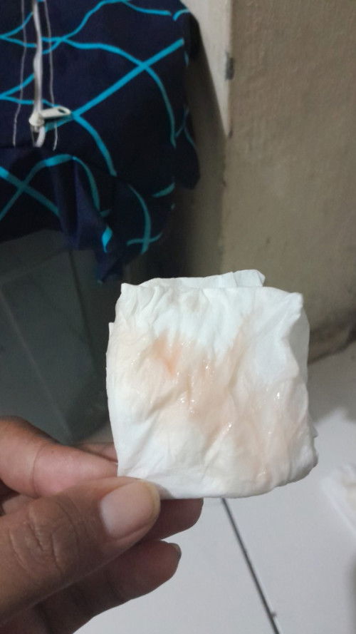 Batu dan keluar darah