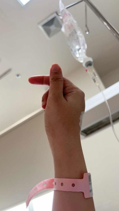 DIAGNOSA KETUBAN PECAH DINI 35w HPL 22 Mei 2024