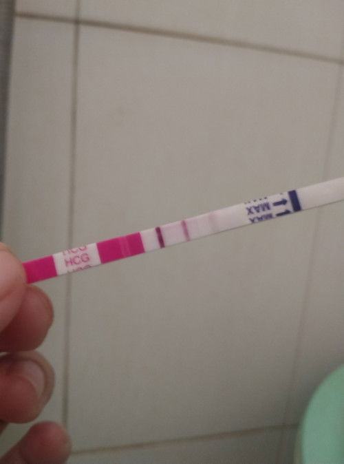 Em trễ 3 ngày thử 2 vạch mà giờ cues đau bụng âm ỉ em tính đợi 10 ngày mới đi siêu âm thì có sao koạ