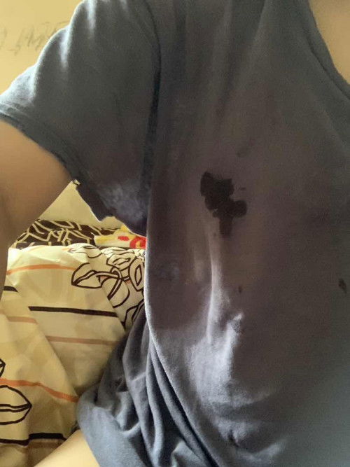 asi rembes saat hamil