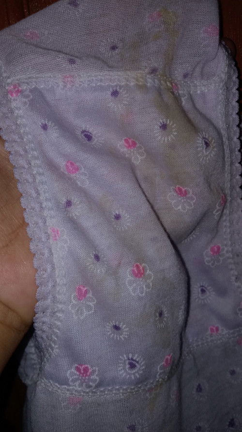 Bercak2 kuning di CD itu keputihan apa bukan ya? Perut bagian bawah kadang nyeri kram ringan UK 34w