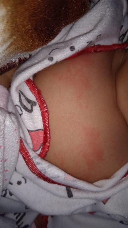 Merah2 area dada dan tangan