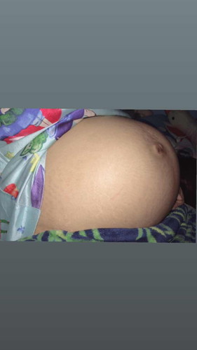 36+5 วีค ท้องแข็ง