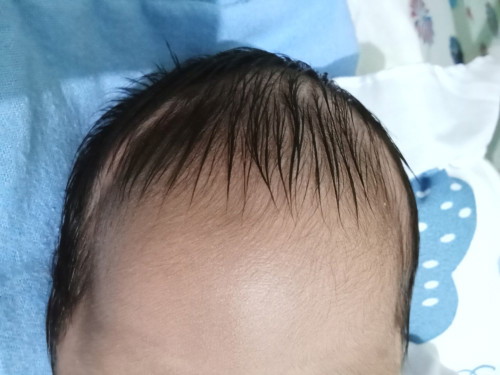 Shape ng ulo ni baby