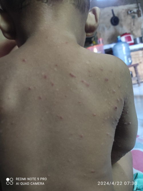 Bintik bintik terus berair