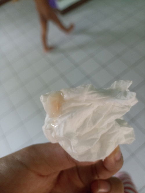 38+6มีมูกแต่ไม่ปวดท้อง