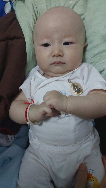 ช่วยด้วย ลูกเป็นผื่นแดงเป็นๆหายๆคะ