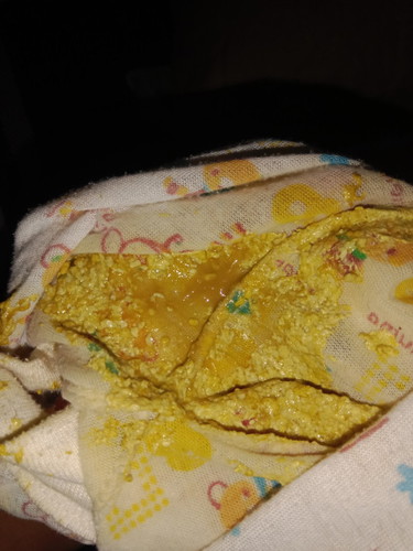 Bayi 3 bulan wajar gak ee berlendir .. Sehari bisa 5-6 kali ee