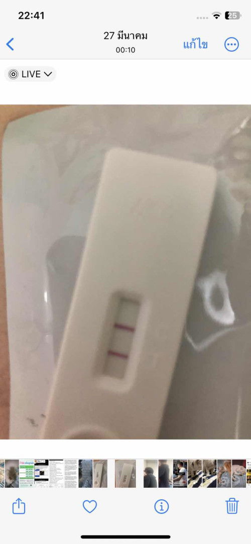 หลังจากเสียลูกไปเมื่อปลายปีที่แล้ว
ผ่านมา4เดือนตอนนี้น้องมาแล้วนะคะ🥰