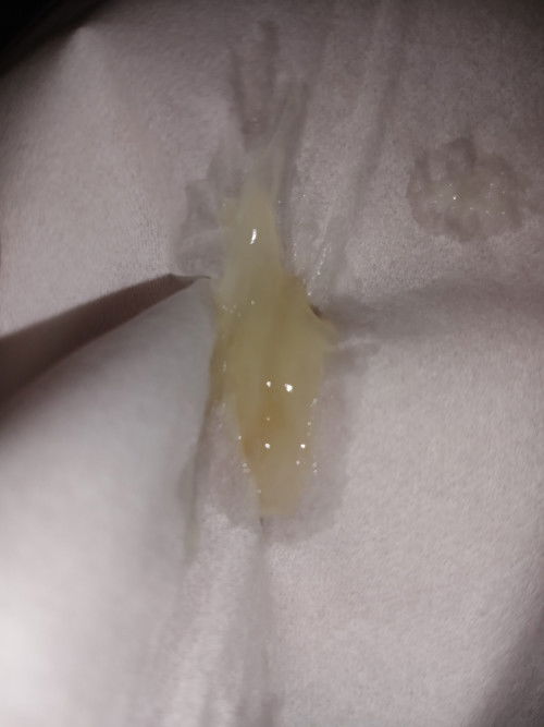 Keluar lendir di usia kehamilan 40 week