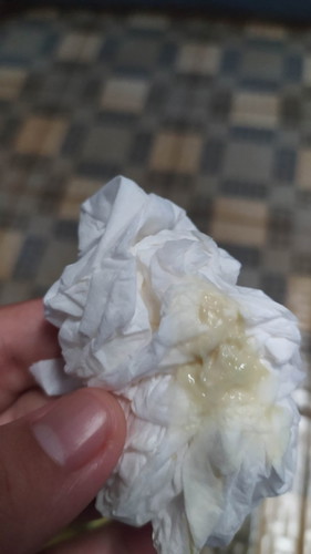 KEPUTIHAN APA AIR KETUBAN YA