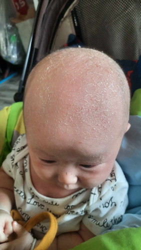 ทำอย่างไรดีครับเครียดมากเลยครับ