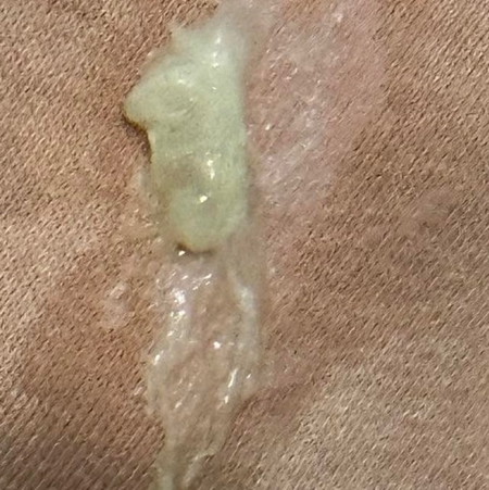 Adakah ini mucus plug