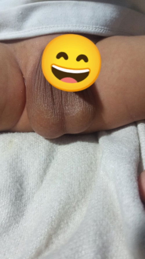 Bakit lumalawlaw itlog ng baby