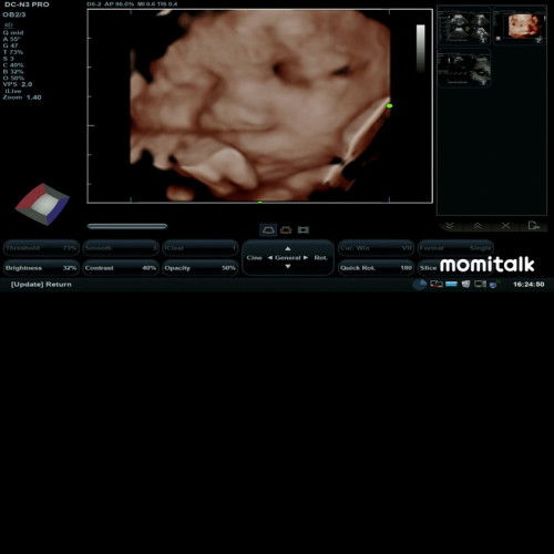 37 week belum masuk panggul