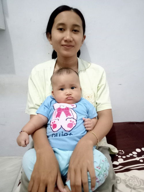 Kepala bayi 4Bulan belum tegak