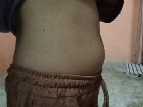 ท้องอ้วนหรือท้องตั้งครรภ์??