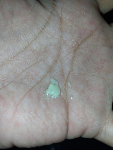 Hello mga mii sino po dito may exper. na nagkaroon ng mucus sa urine gaya nyan ,no uti ..14wks preg.