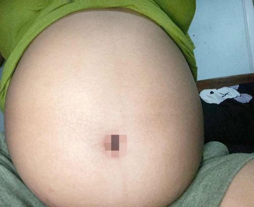 รู้สึกคันๆใต้ท้องค่ะเกาดีมั้ยคะ