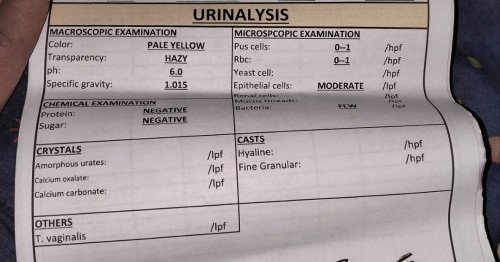 Urinalysis ng result ko..